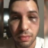 «Me atacaron entre 6 hombres»: habló el joven que ligó brutal golpiza a la salida de una discoteca